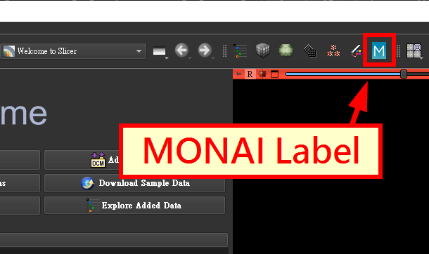 MONAI Label 按鈕